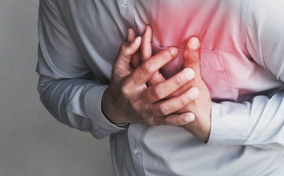  ¿コラソンとの関係はどのようなものですか?